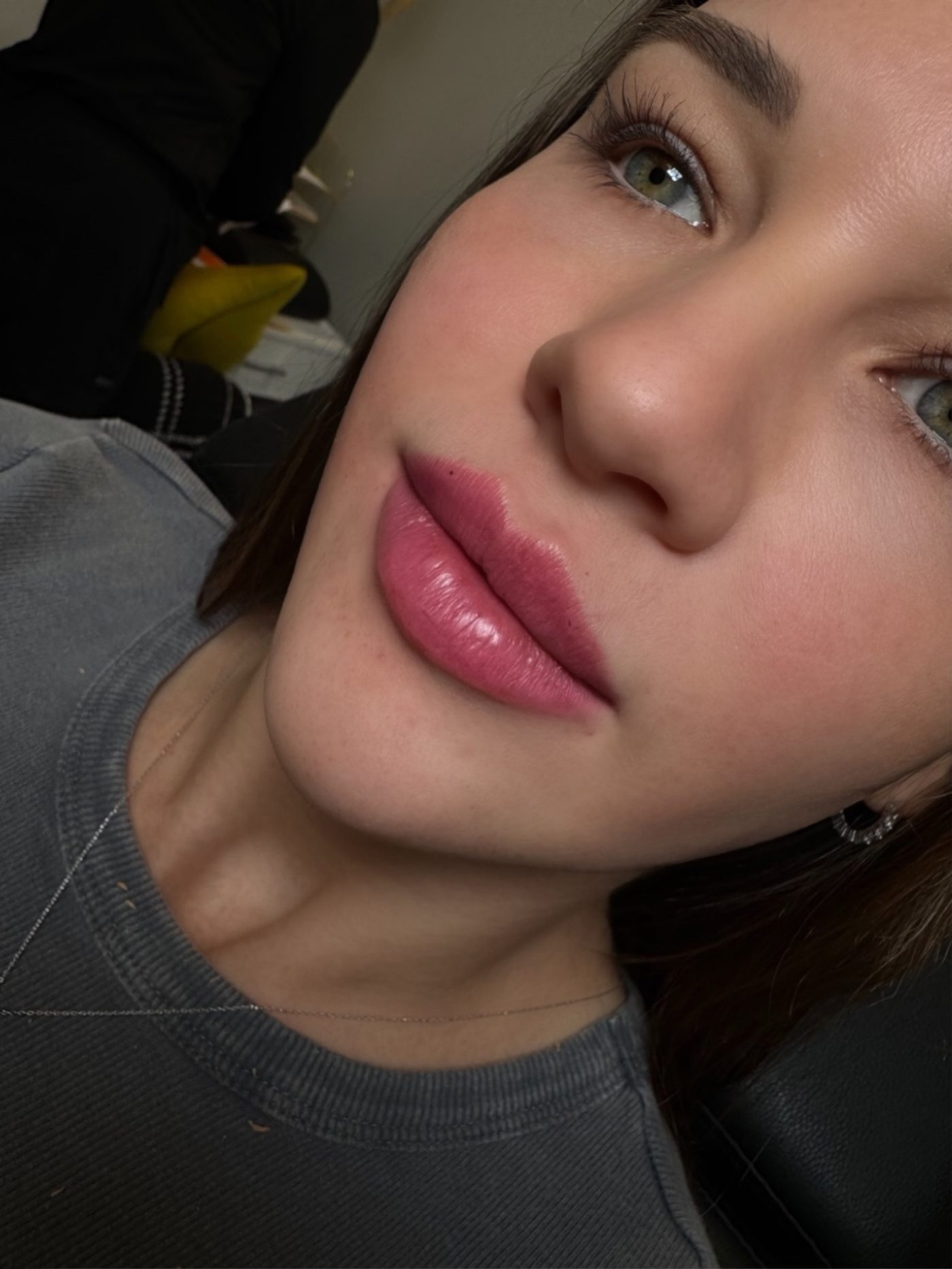 Natural, balanced lip enhancement and glowing skin result — facial harmony at Mirror by Nurse Yara
