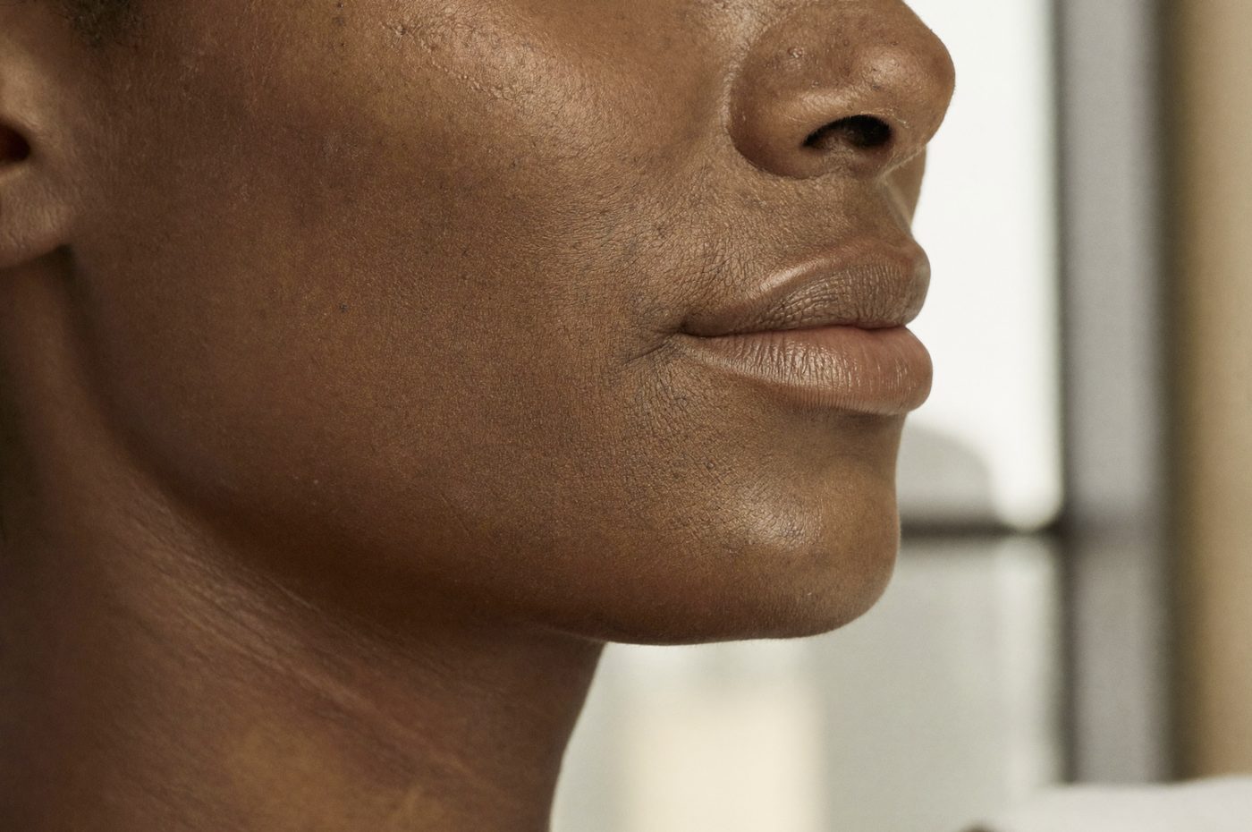 Balanced facial profile in natural light — facial harmony at Mirror by Nurse Yara