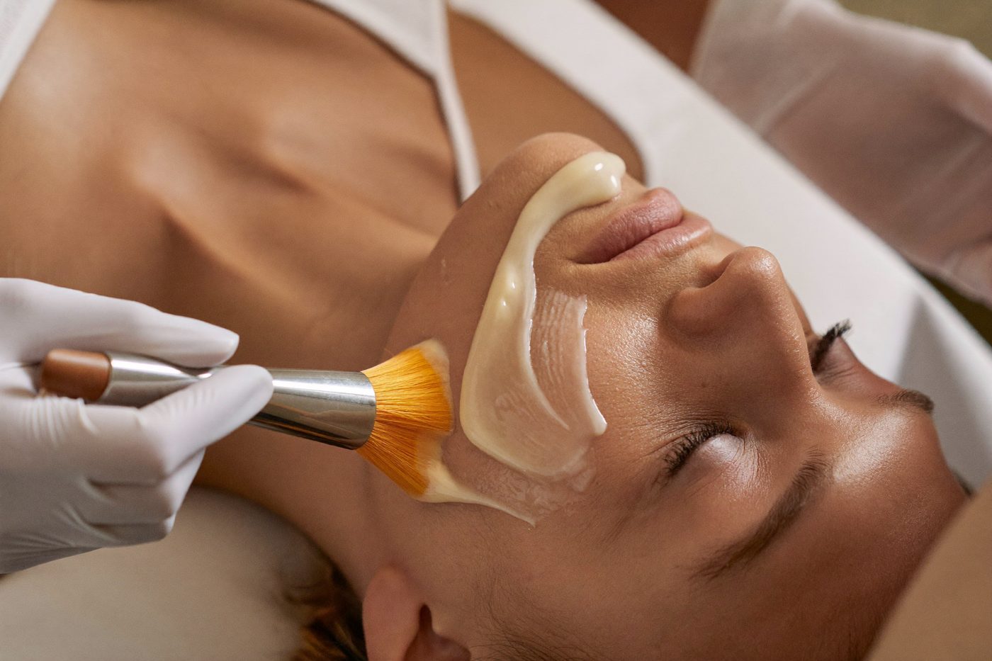A fan brush applying chemical peel solution to a client's cheek during a medical peel